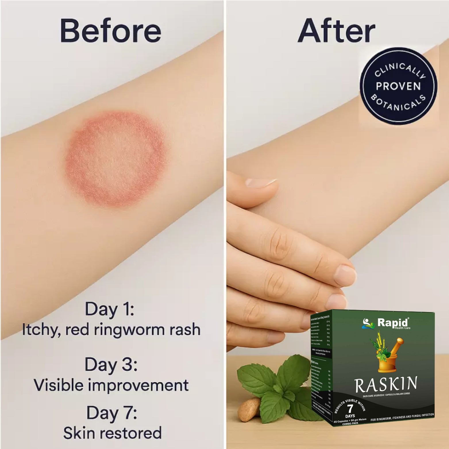 Raskin Skin Care Ayurvedic Capsule & Malam Combo