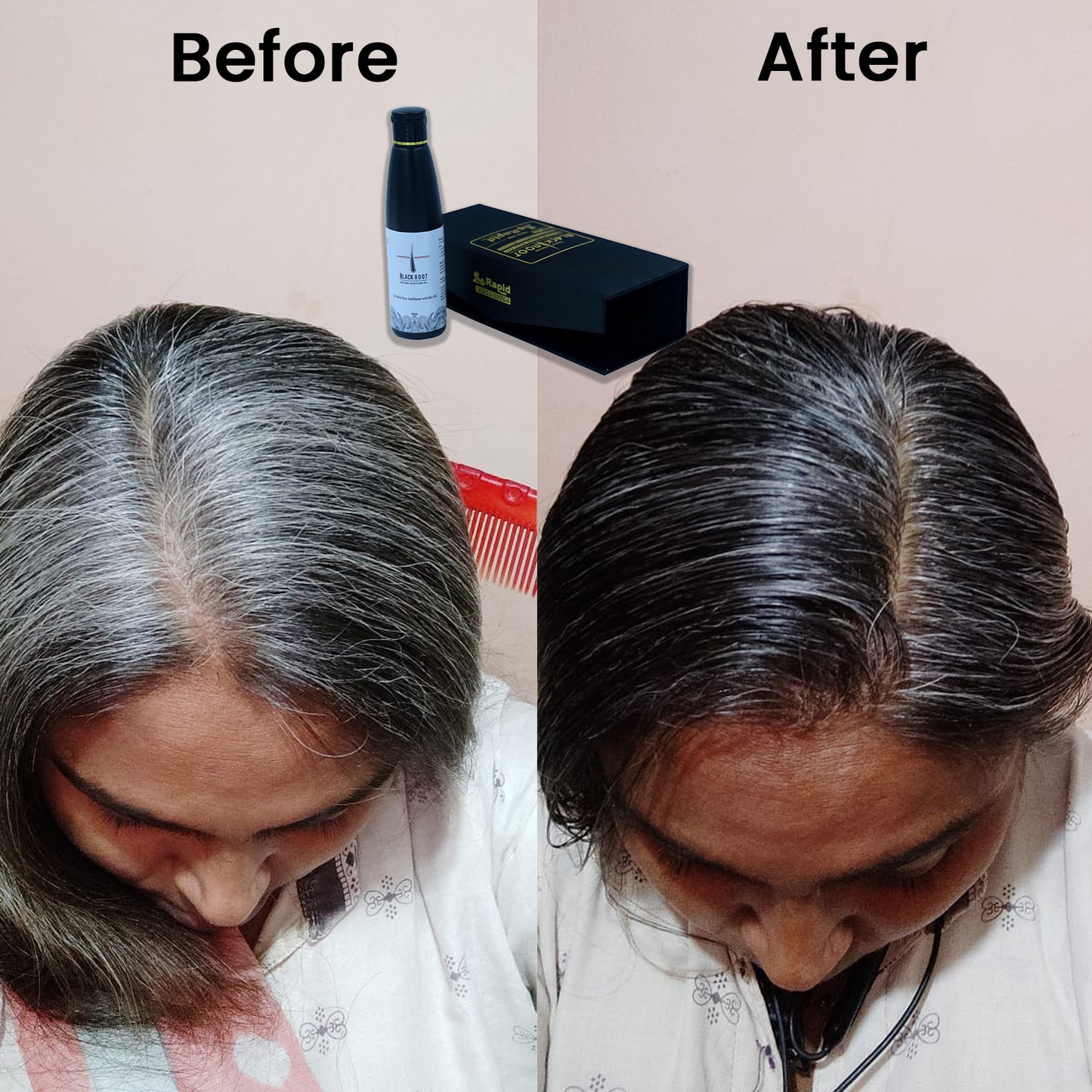 Black Root Natural Hair Oil - 100ml + Free Shampoo 100ml